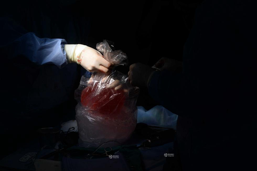 7?? ???, ? ?? ?? ?? ??? ?? ??