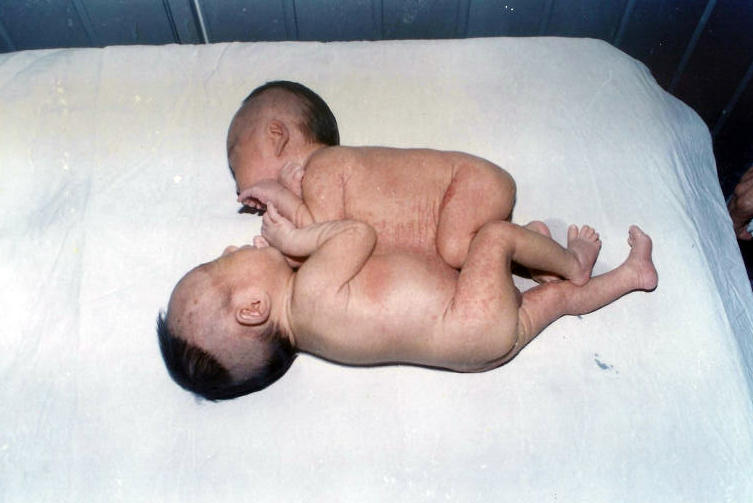 ?? ????, 19? ? ?????? ?? ?? ??