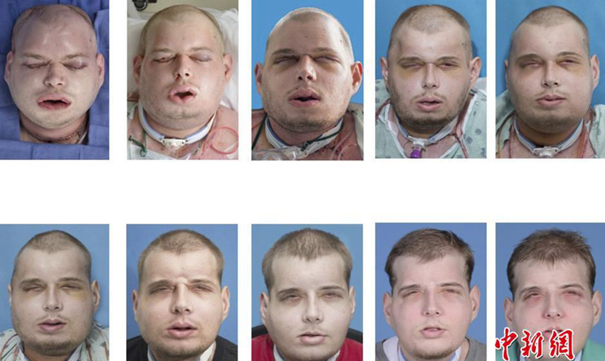 ??大, ???? ?? ??? ?? ?? ?? ??