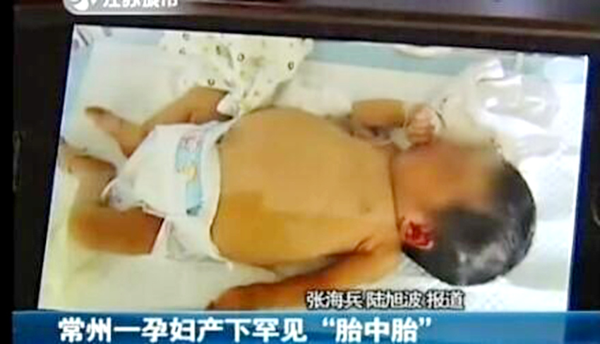 ?! ?? 9? ? ?? ???? ‘????’ ??