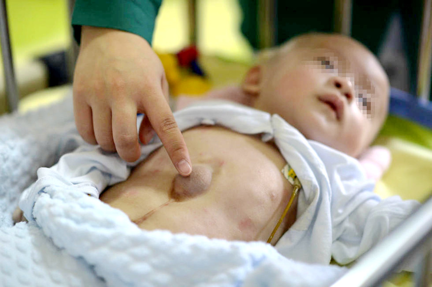 ?? ??? ?? ?? ?? ??, ?? ?? ? ? ???