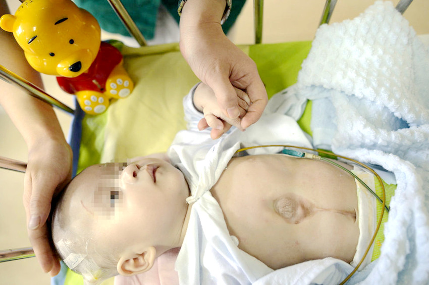 ?? ??? ?? ?? ?? ??, ?? ?? ? ? ???