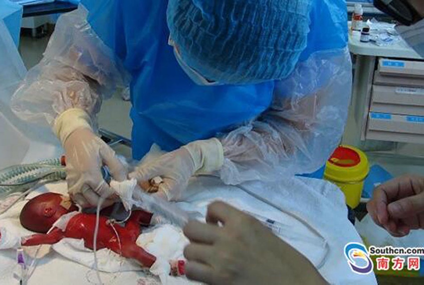 ?? 4?? ?? ??? ????, ???? ? ??