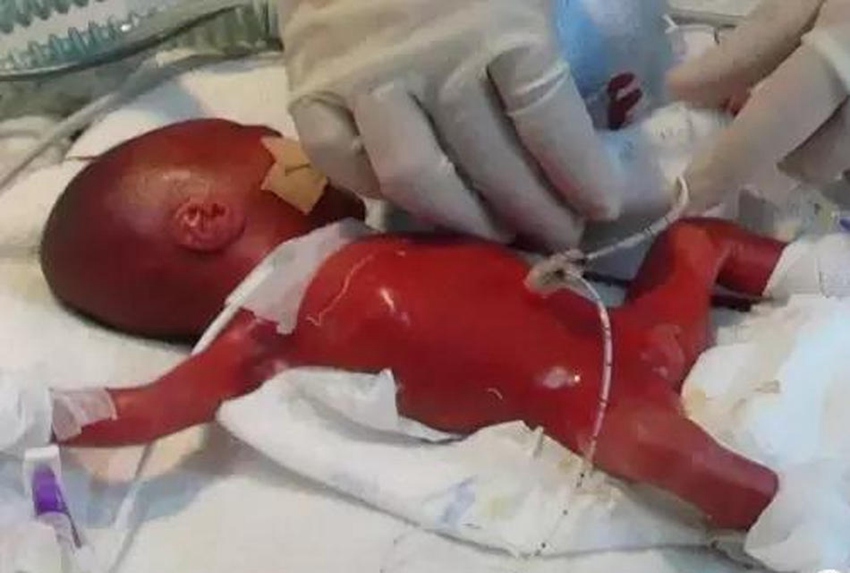 ?? 4?? ?? ??? ????, ???? ? ??