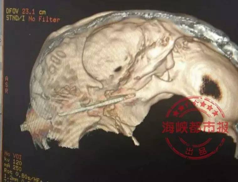 ??? ?? ?? ?? ? 男, ?? ?? ??? ????…