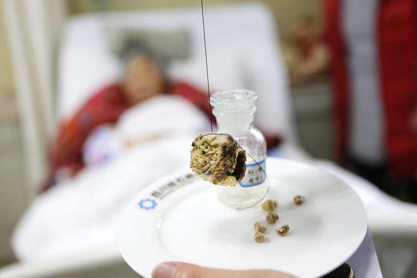 ?? ?? 85? ???, ??? ‘???’? ?? ??!