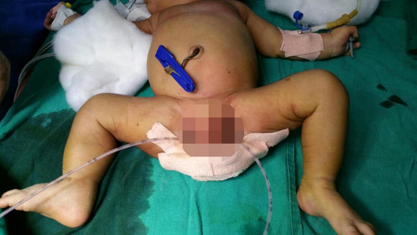 ??? ?? ??! ?? ?? 3? ??? ??? ??, ?? ???